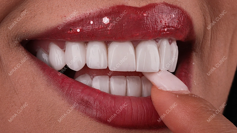 healthy smile